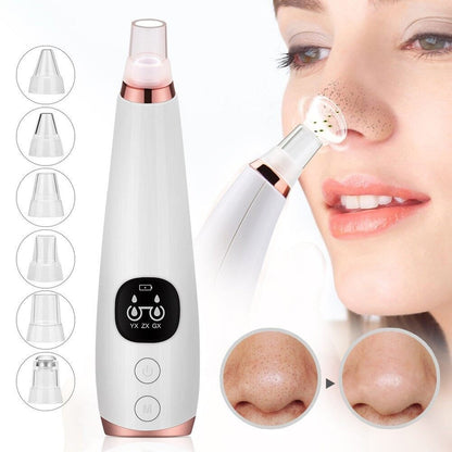 "GlowSkin™ Portable Blackhead Remover"